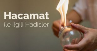 hacamat nedir, hacamat ile ilgili hadisler